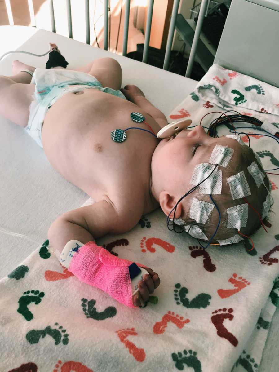 Baby with Aicardi Syndrome lays on back in crib in hospital with cast on her wrist and patches all over her head