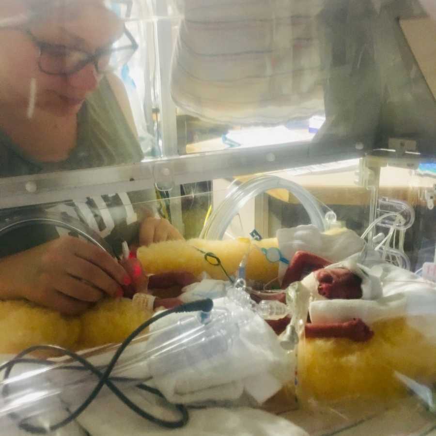 Mother stands beside intubated preemie who lays in NICU