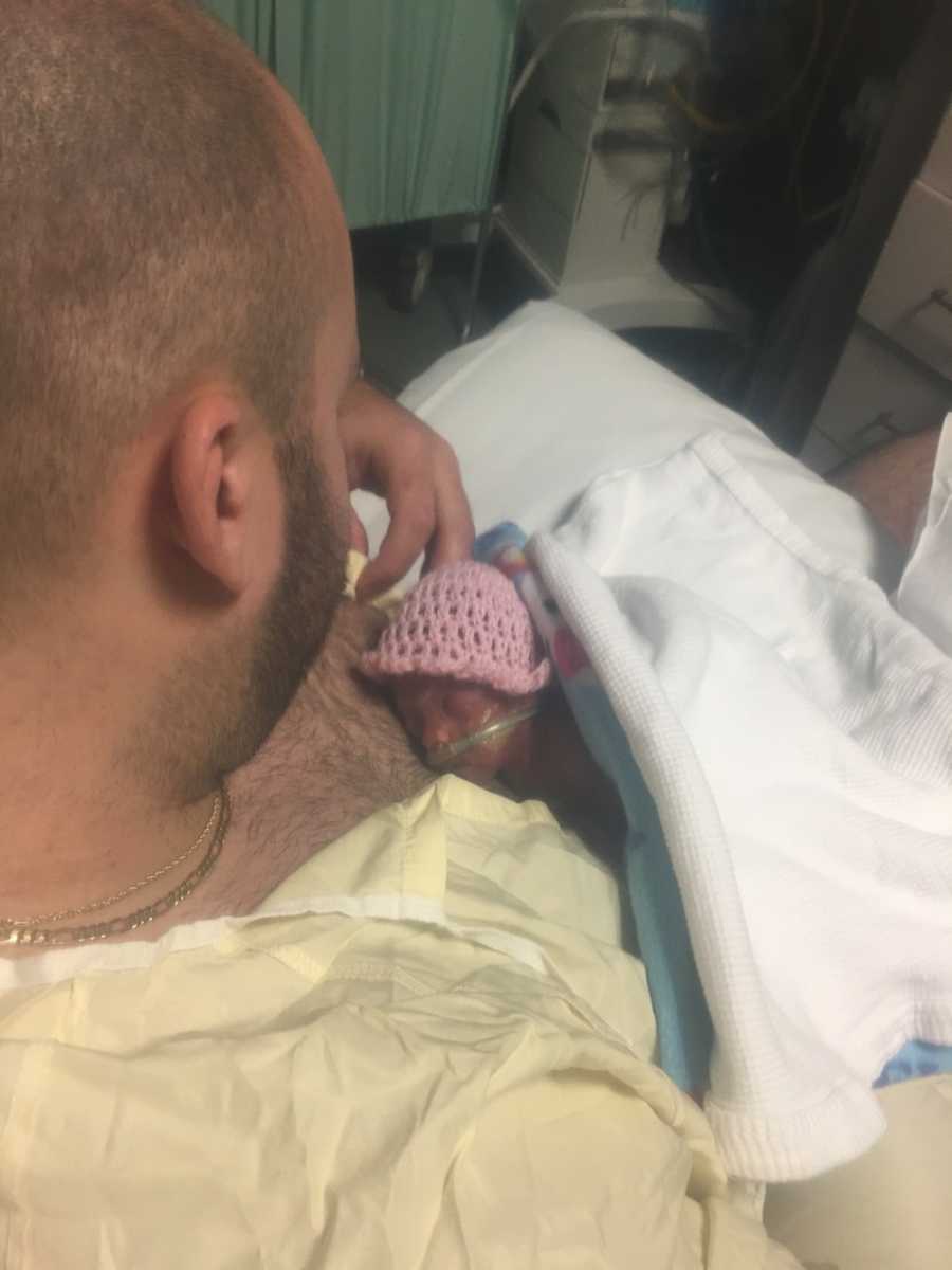 Intubated preemie lays asleep on bare chest of father