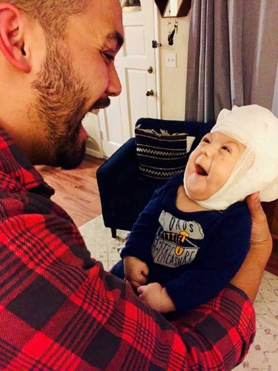 Father smiles at baby son with Saethre-Chotzen Syndrome as he holds him in home with bandages wrapped around his head