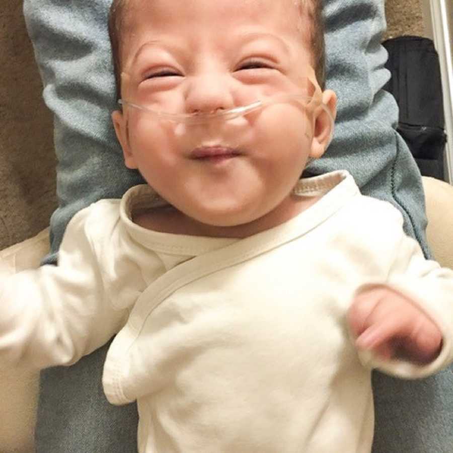 Baby boy with Saethre-Chotzen Syndrome lays on back smiling 