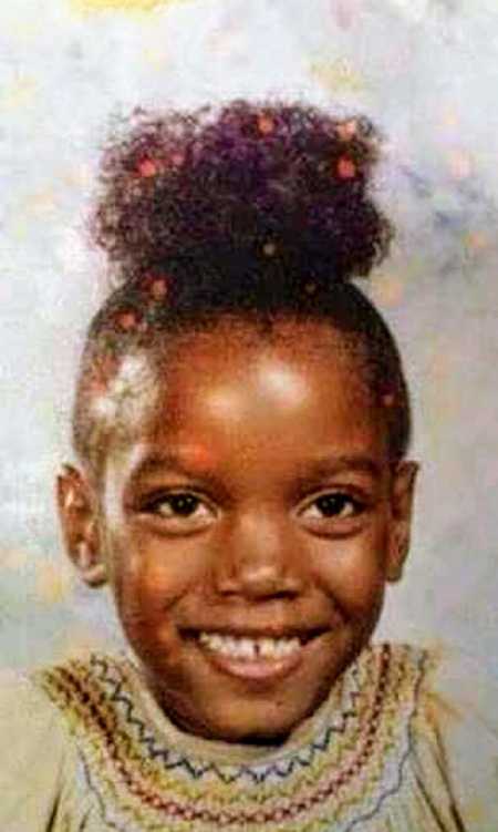 Young girl with vitiligo smiles for school picture