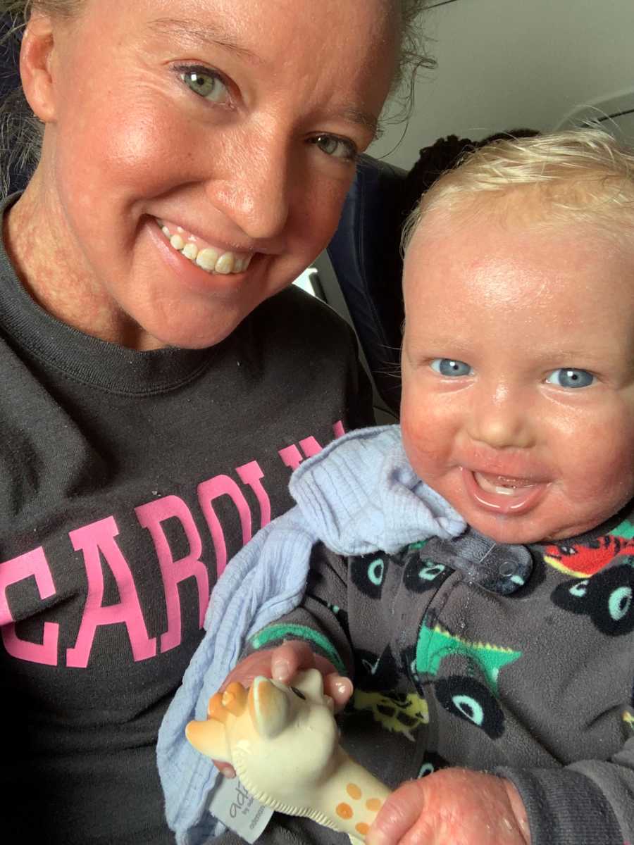 Mother and son with Ichthyosis smile on plane before they got kicked off