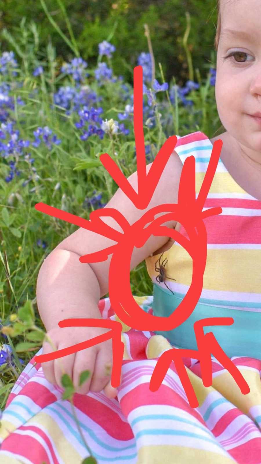 Spider on Child