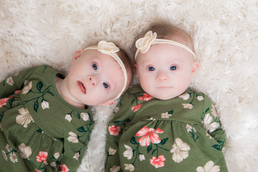 'We were literally one in a million. Identical twins with ...