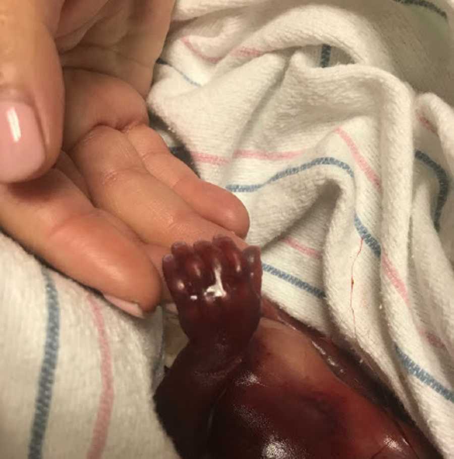 Grieving mom holds hand of stillborn baby