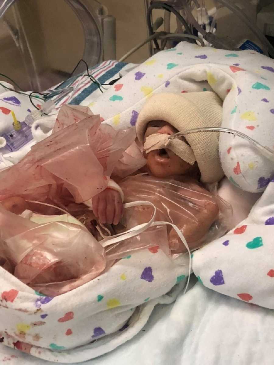 Premature baby boy in cream-colored hat