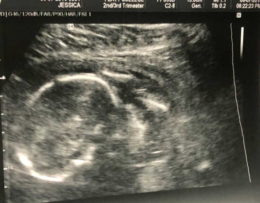 Ultrasound photo of baby boy