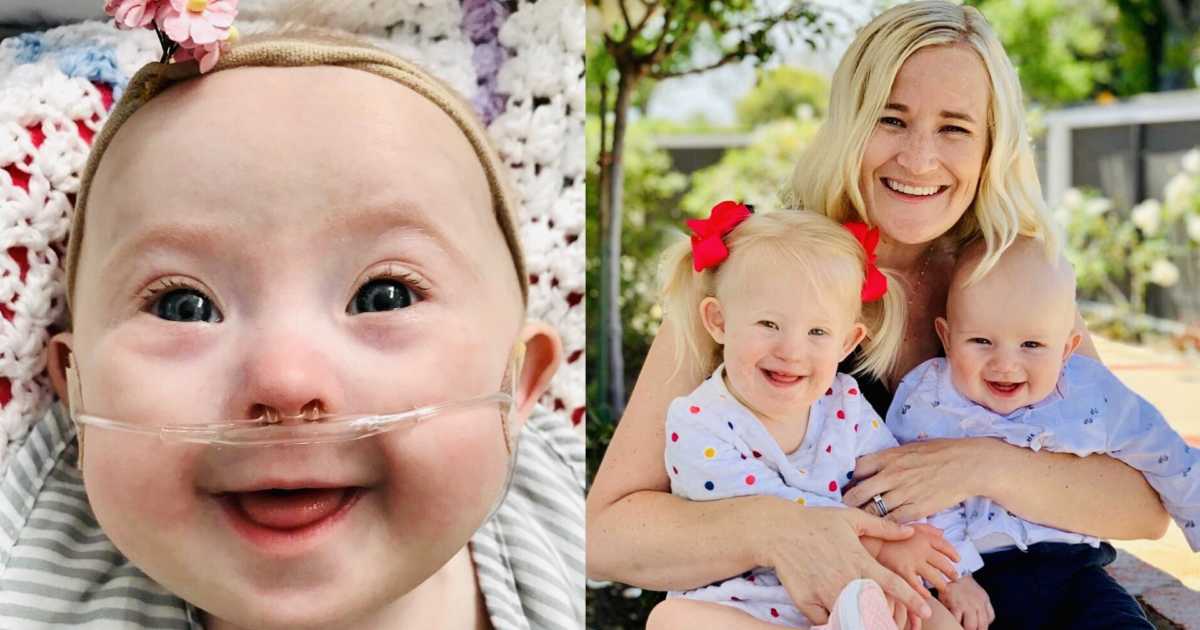 ‘I have to tell you something. I’m so sorry.’ I burst into tears. I hated others being sad about our baby.’: Parents shocked by Down syndrome diagnosis after signing paperwork to not do genetic testing, ‘We are keeping the baby’
