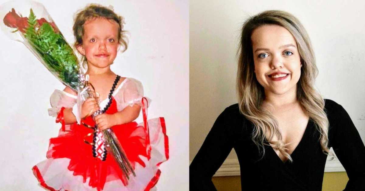‘What’s it like being a little person?’ I was touched without my ...