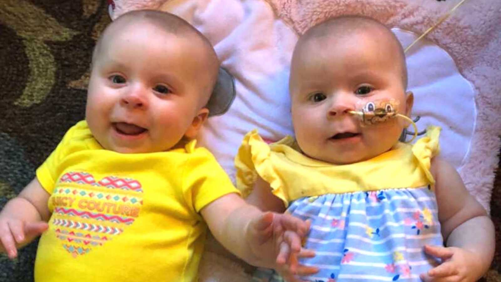 Ella had tumors in BOTH eyes. 'Your twins have cancer.' Things would never  be the same.': Family copes with shocking cancer diagnosis for twins – Love  What Matters