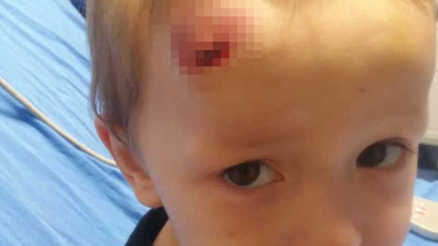 Losing Son To Abusive Babysitter, Baby Fell And Hit Head On Hardwood Floor Reddit