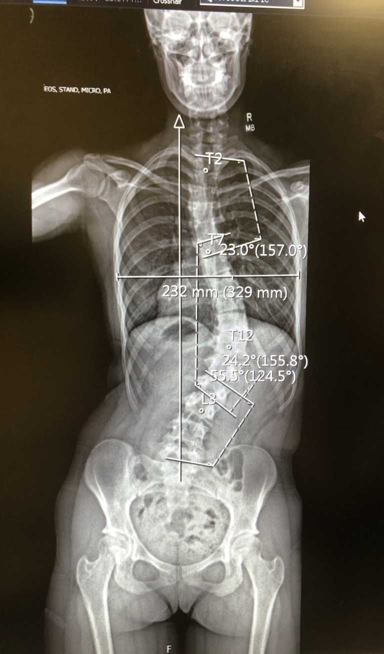 ‘There’s no way that crooked spine is mine.’ I had no idea what was