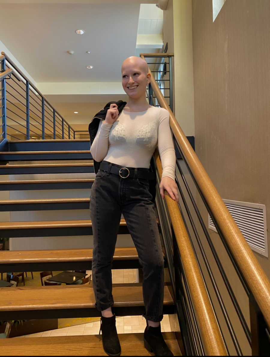 Woman with alopecia learning self-acceptance