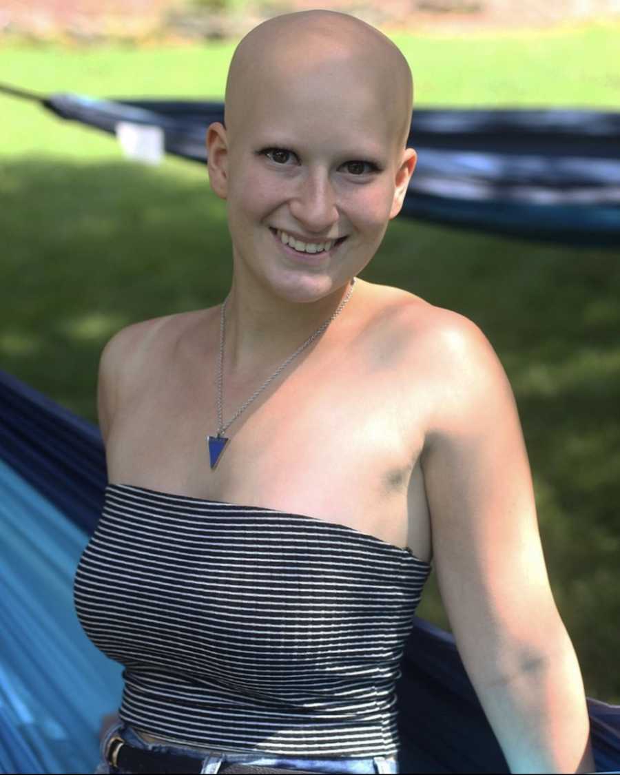 Woman with alopecia smiling in the sun