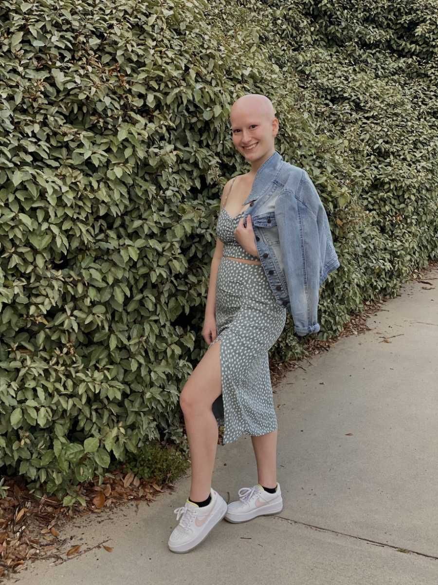 Woman with alopecia posing