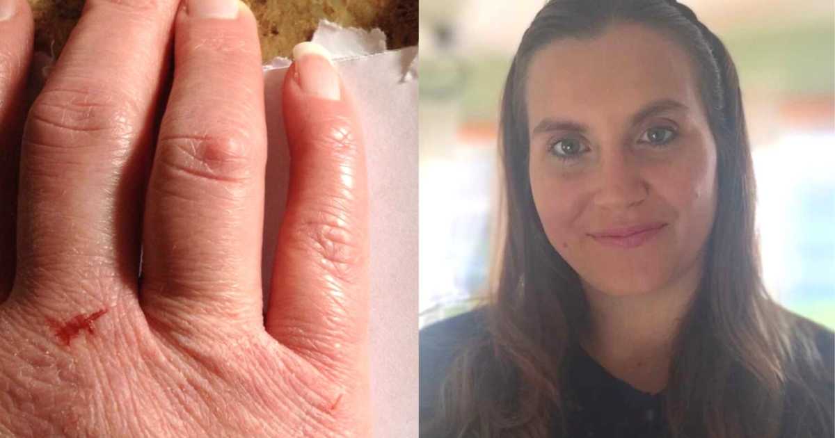 ‘God, it’s okay if you want to take me tonight.’ I was so frustrated with myself and my disease.’: Lupus warrior says ‘I will never again lose hope’