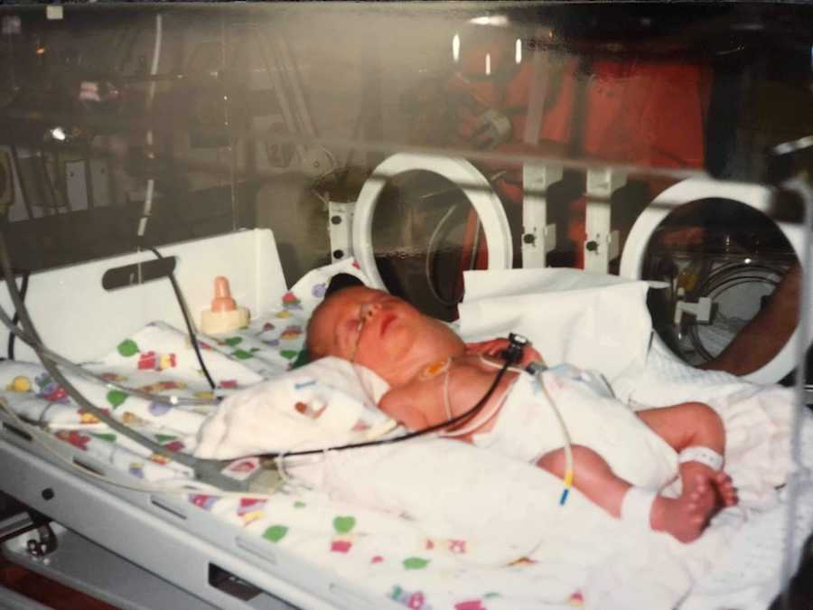 Newborn baby in NICU