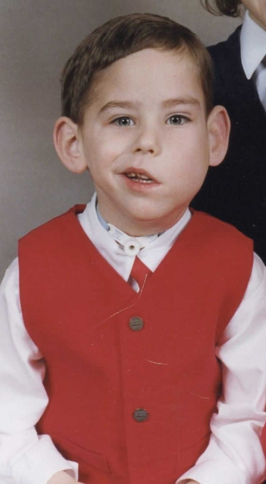 Boy with cystic hygroma smiling