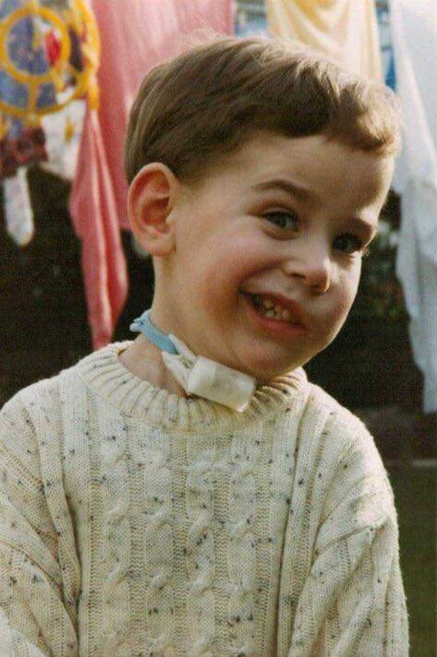 Boy with tracheostomy smiling