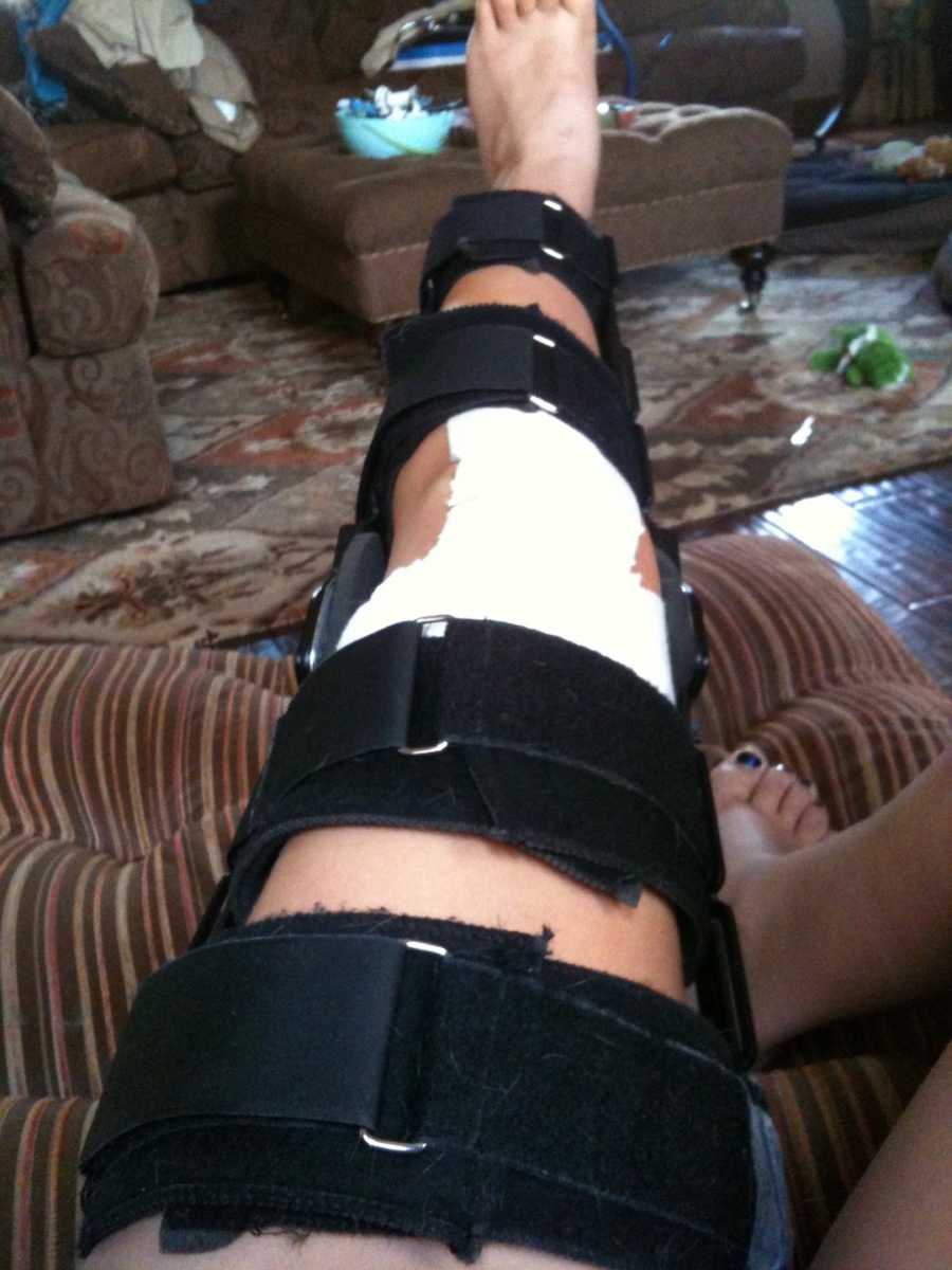 knee surgery