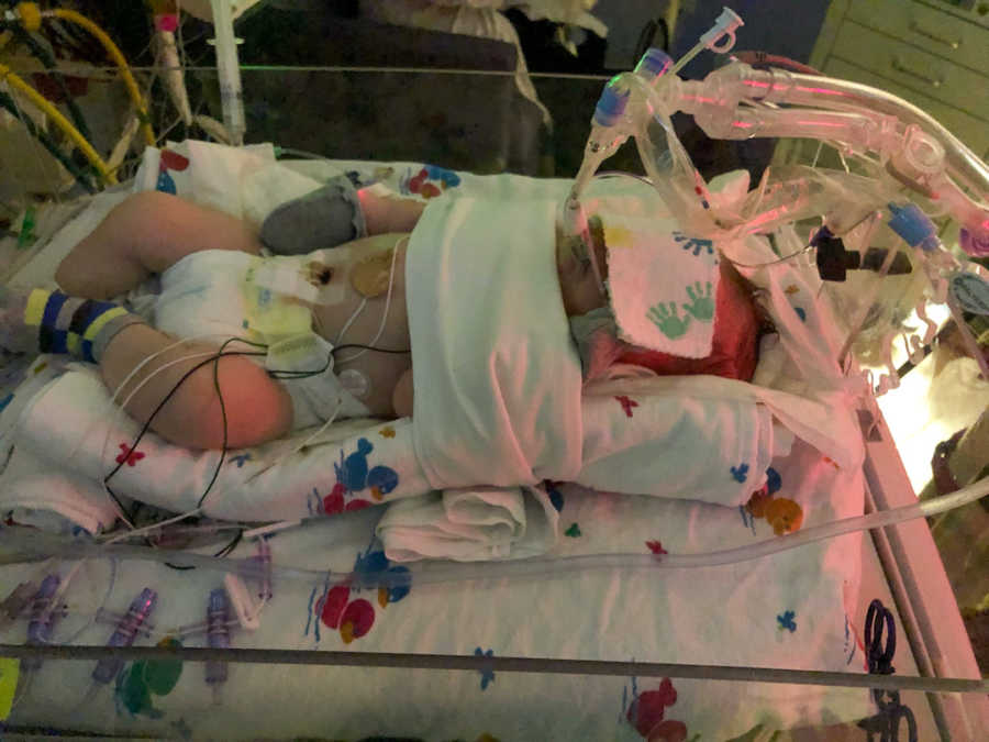 baby in NICU with tubes