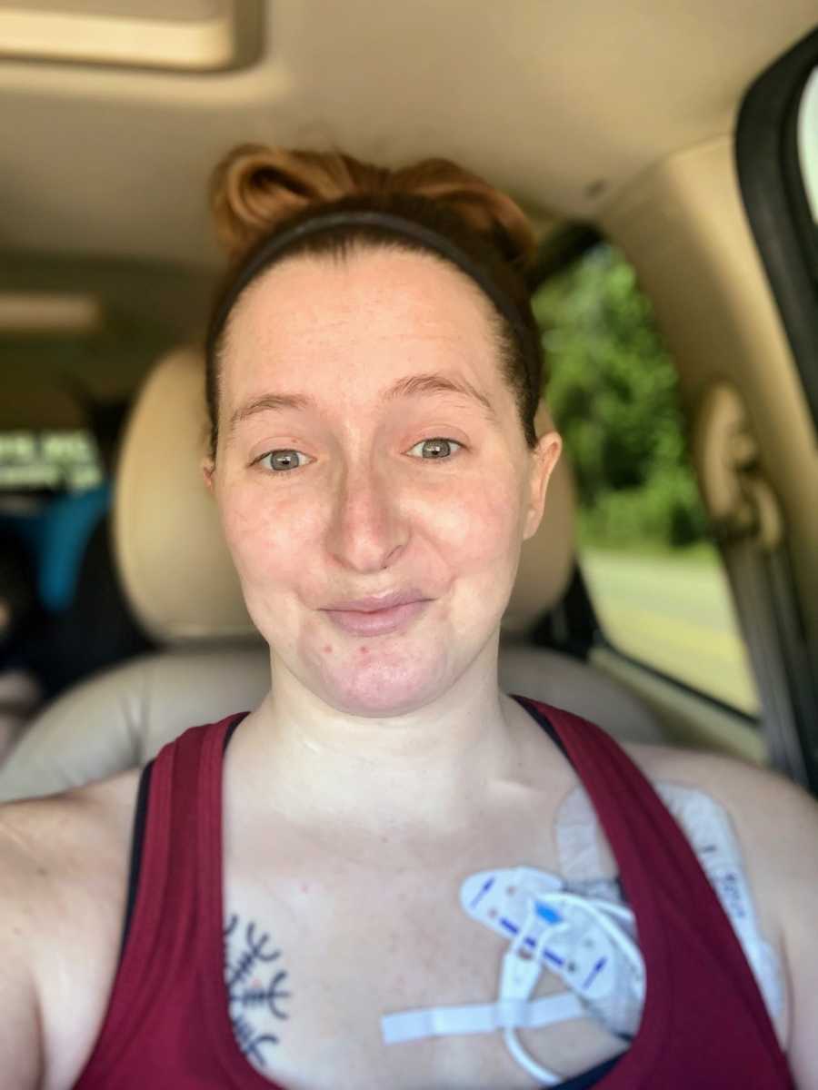 A disabled woman sits in her car wearing patches and wires