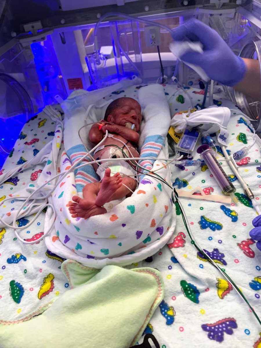 Premature baby in incubator wrapped in blankets