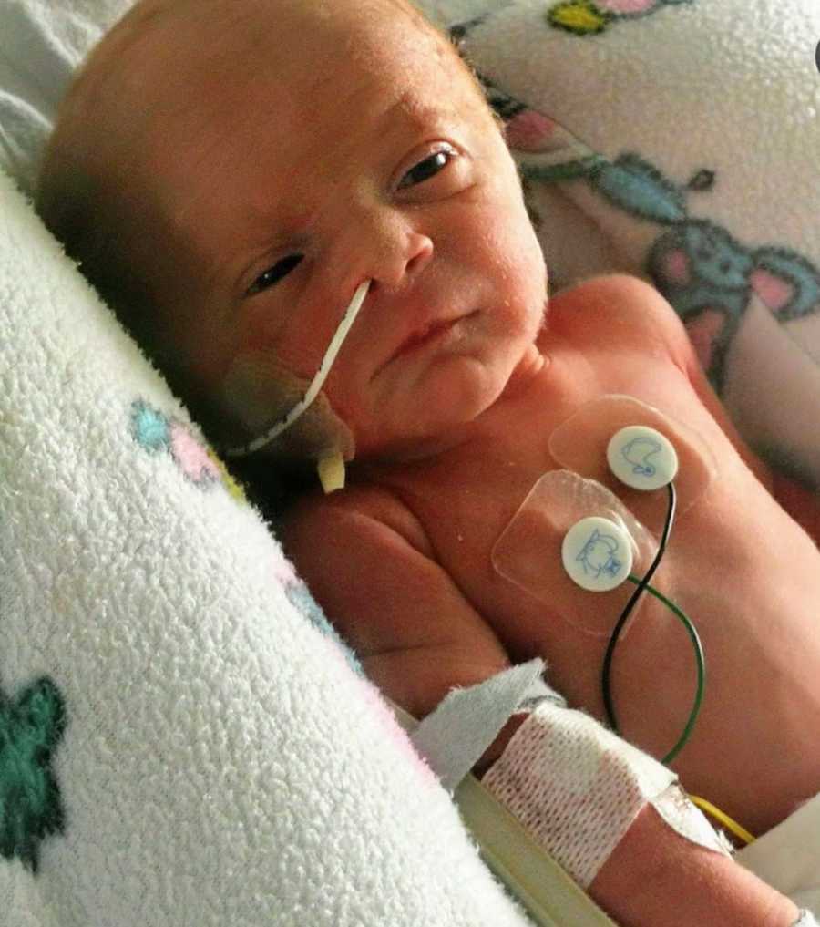 Newborn baby girl with wires in hospital 
