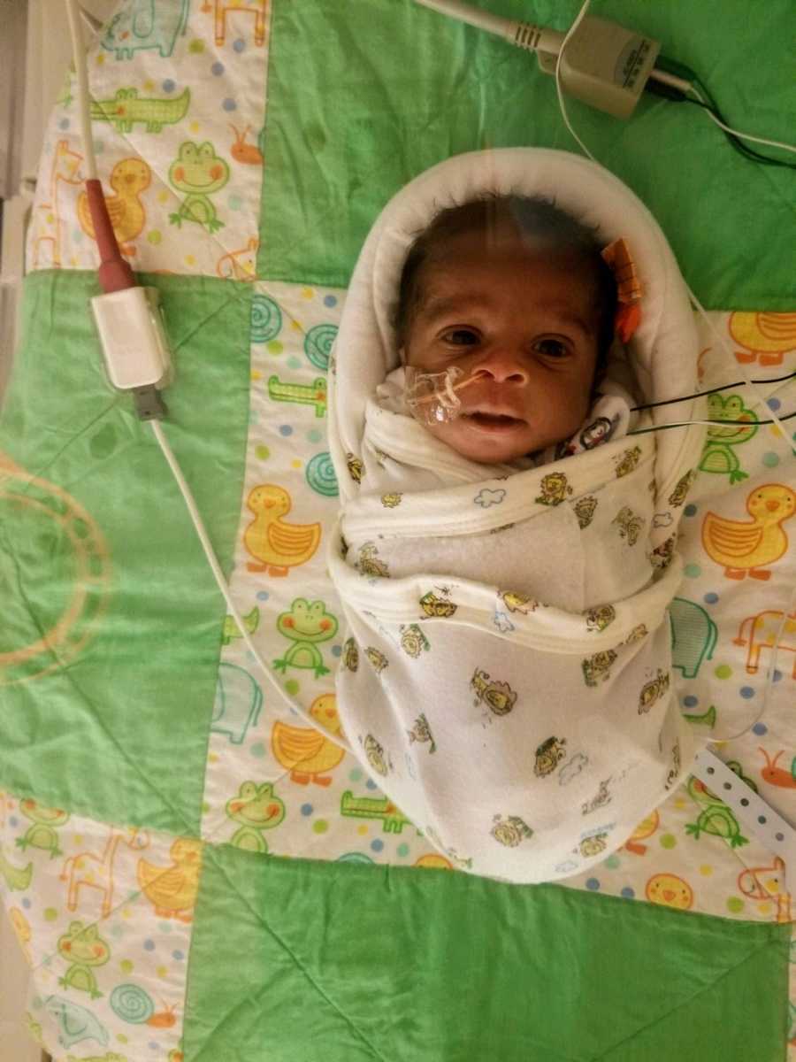 A premature baby boy swaddled with tubes and wires connected