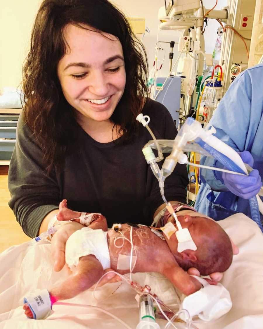 Young mother holding premature baby on life support