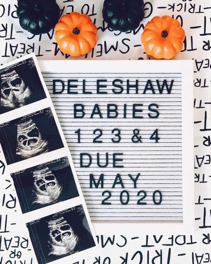 Birth announcement on a letterboard with black and orange pumpkins and ultrasound images