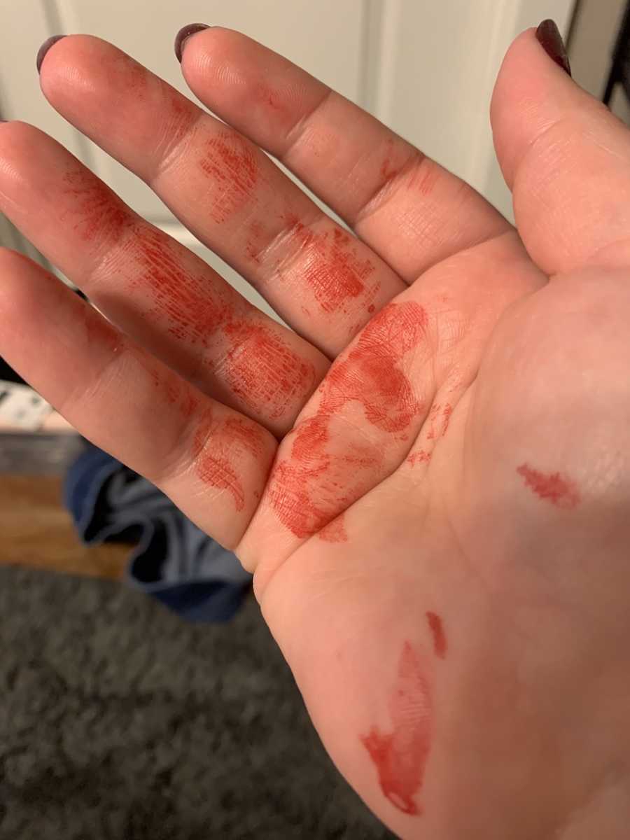 Blood on hands
