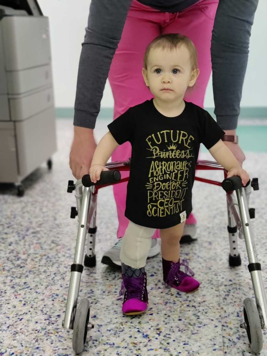 baby with rare condition learning to walk