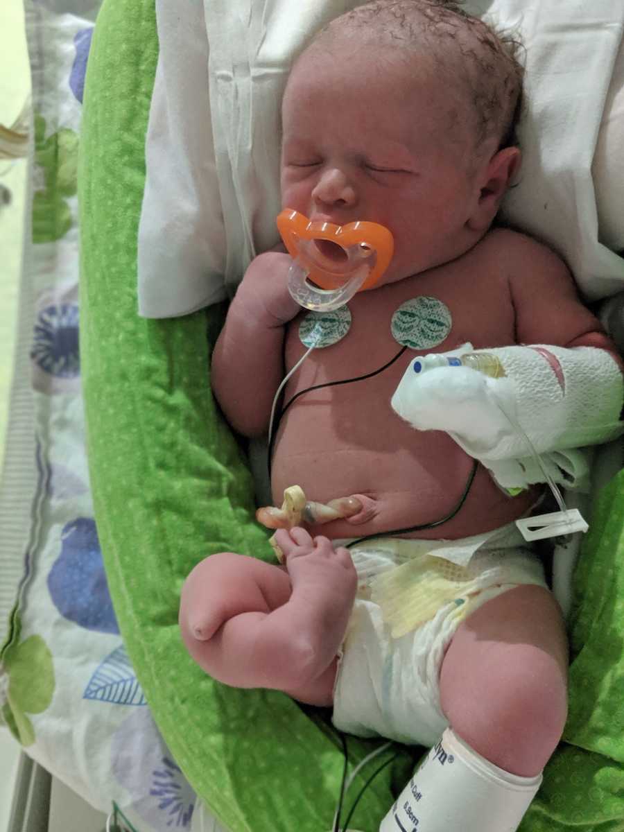 newborn with genetic condition