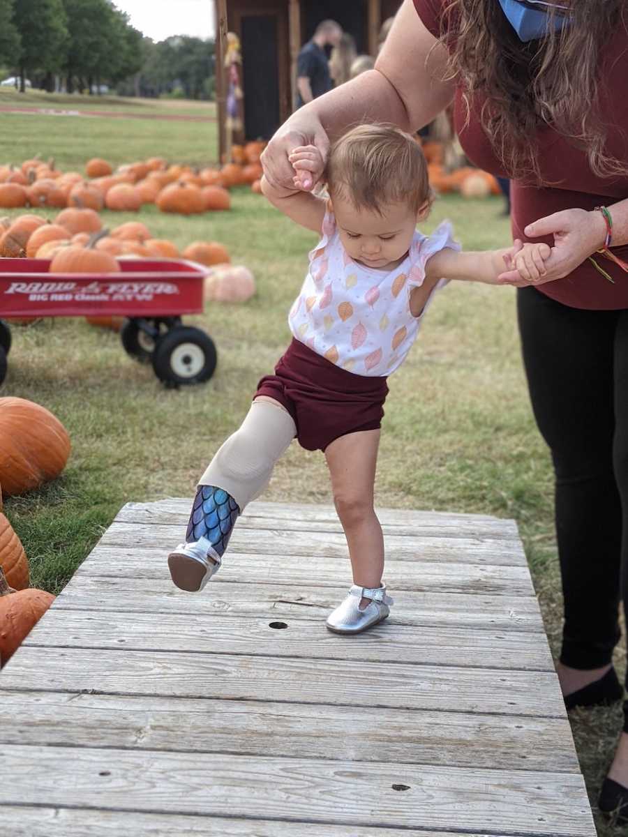 baby with prosthetic learning to walk