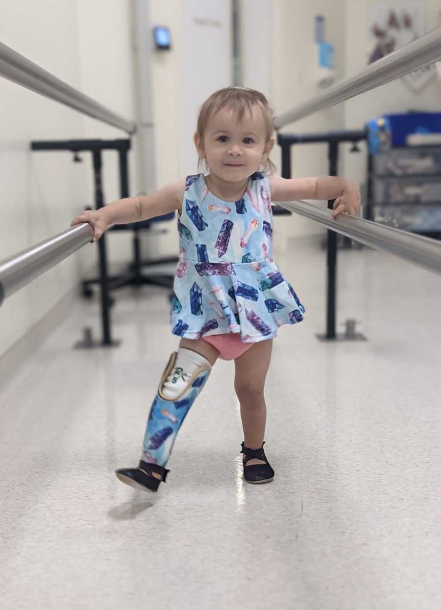 baby with prosthetic learning to walk