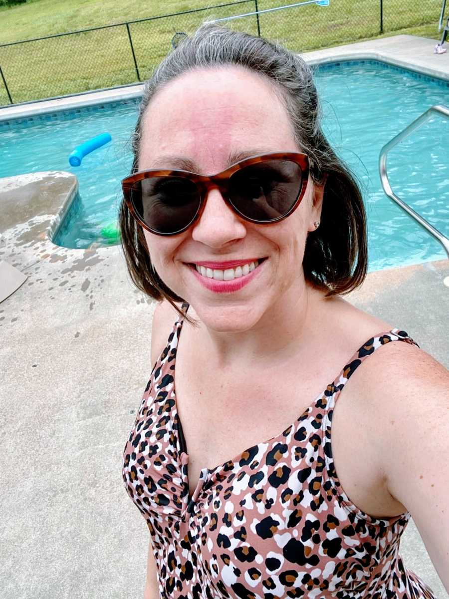 Mom takes bikini selfie near the pool, embracing her birthmark and signs of aging