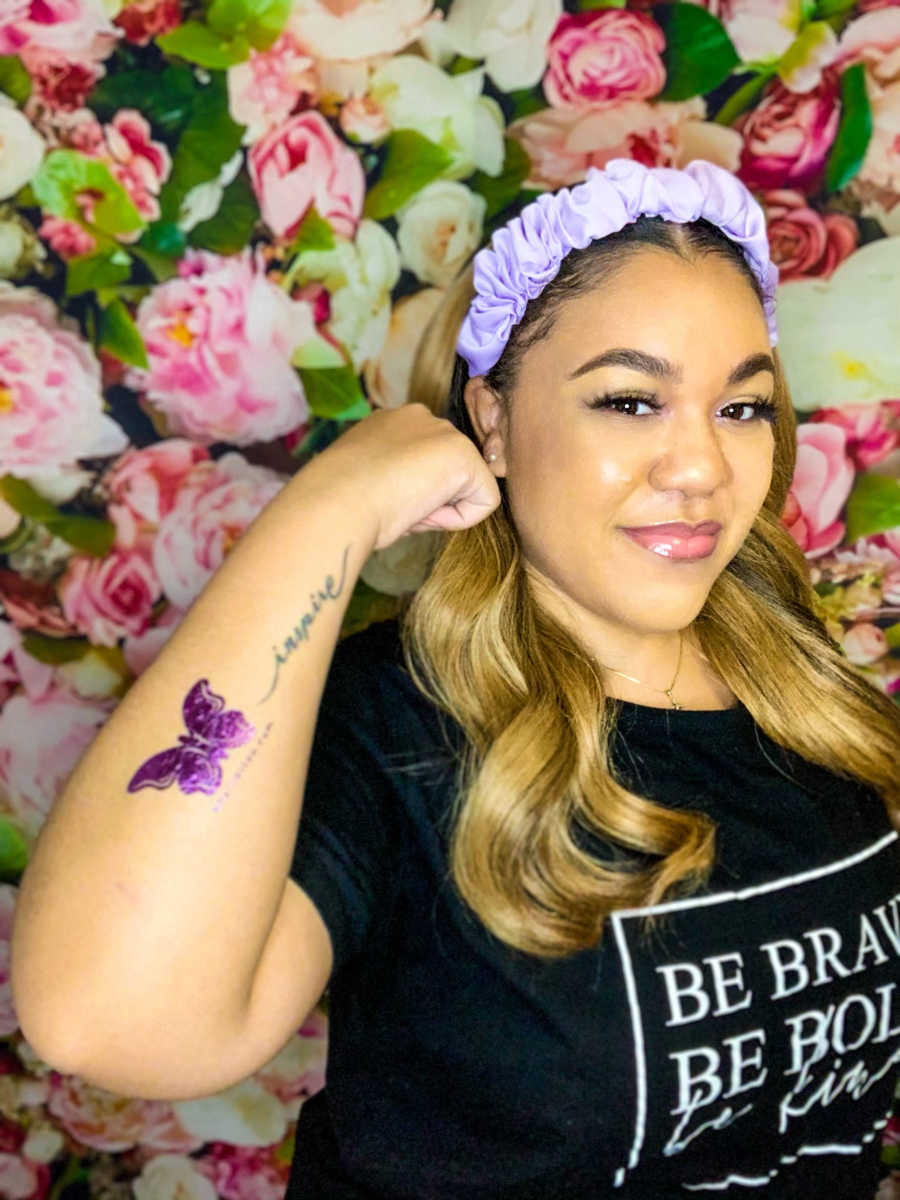 young woman posing, purple lupus butterfly on arm