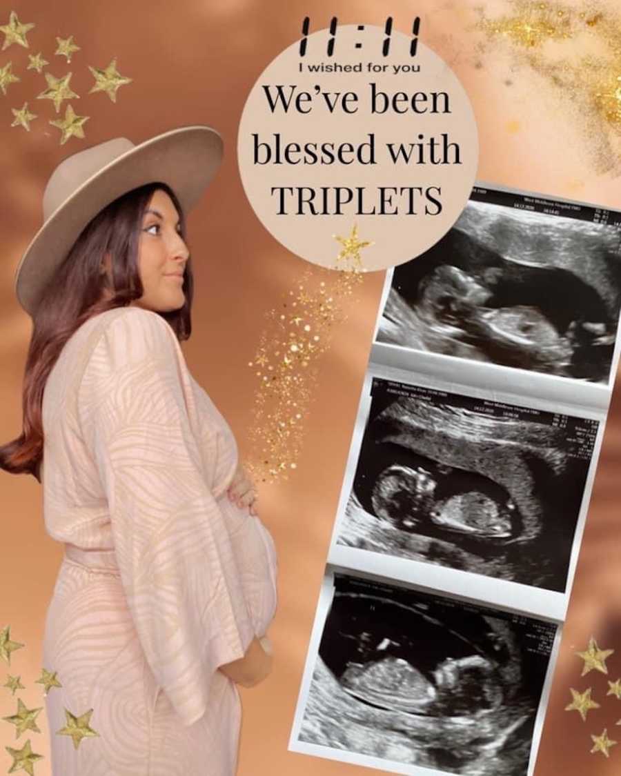 Triplet pregnancy announcement