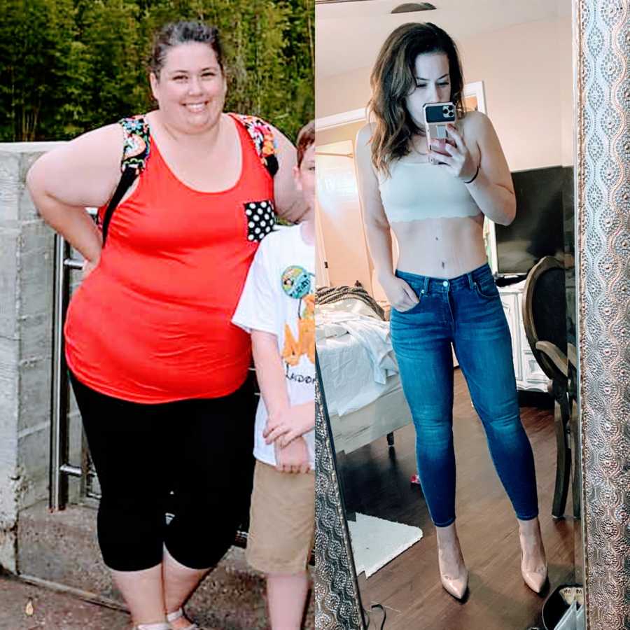 Woman shows before and after photos of her body before and after a gastric bypass, changes to a healthy lifestyle