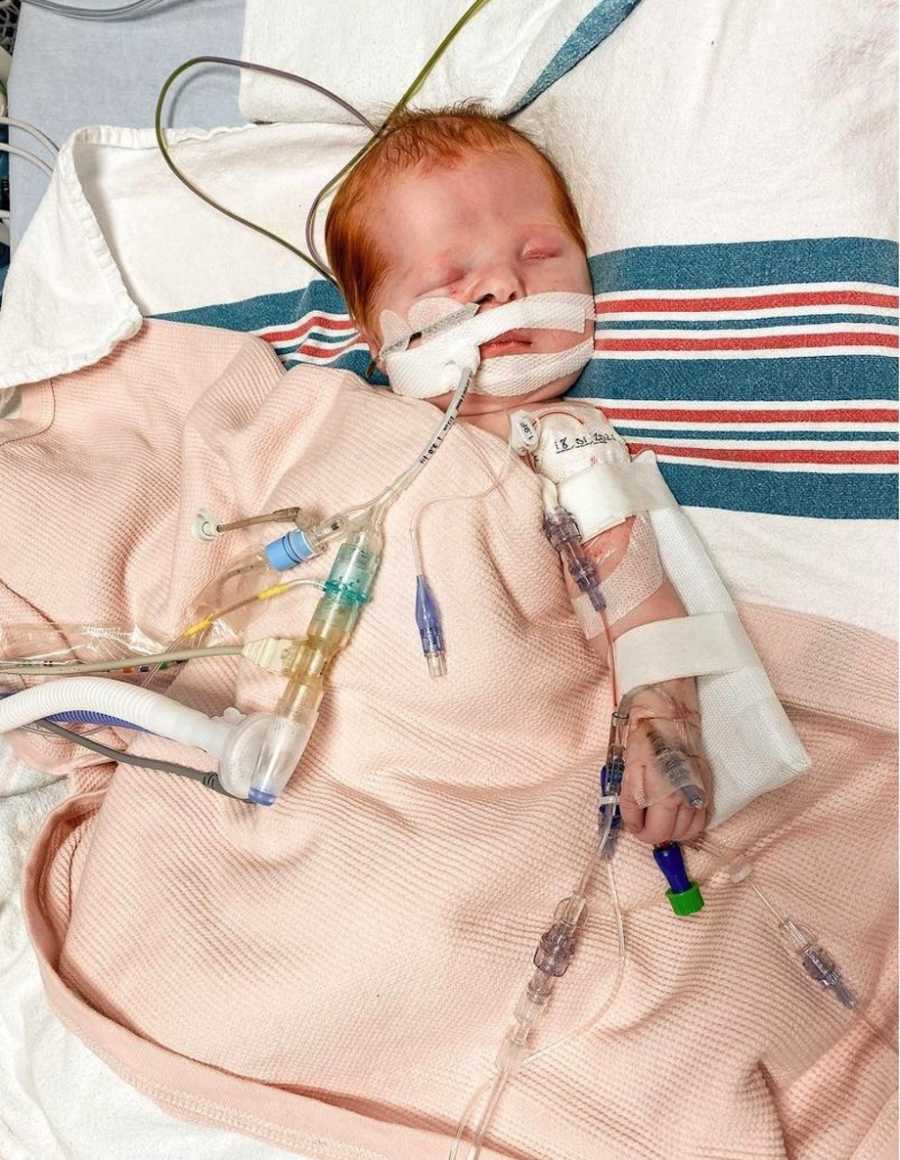 Baby in NICU