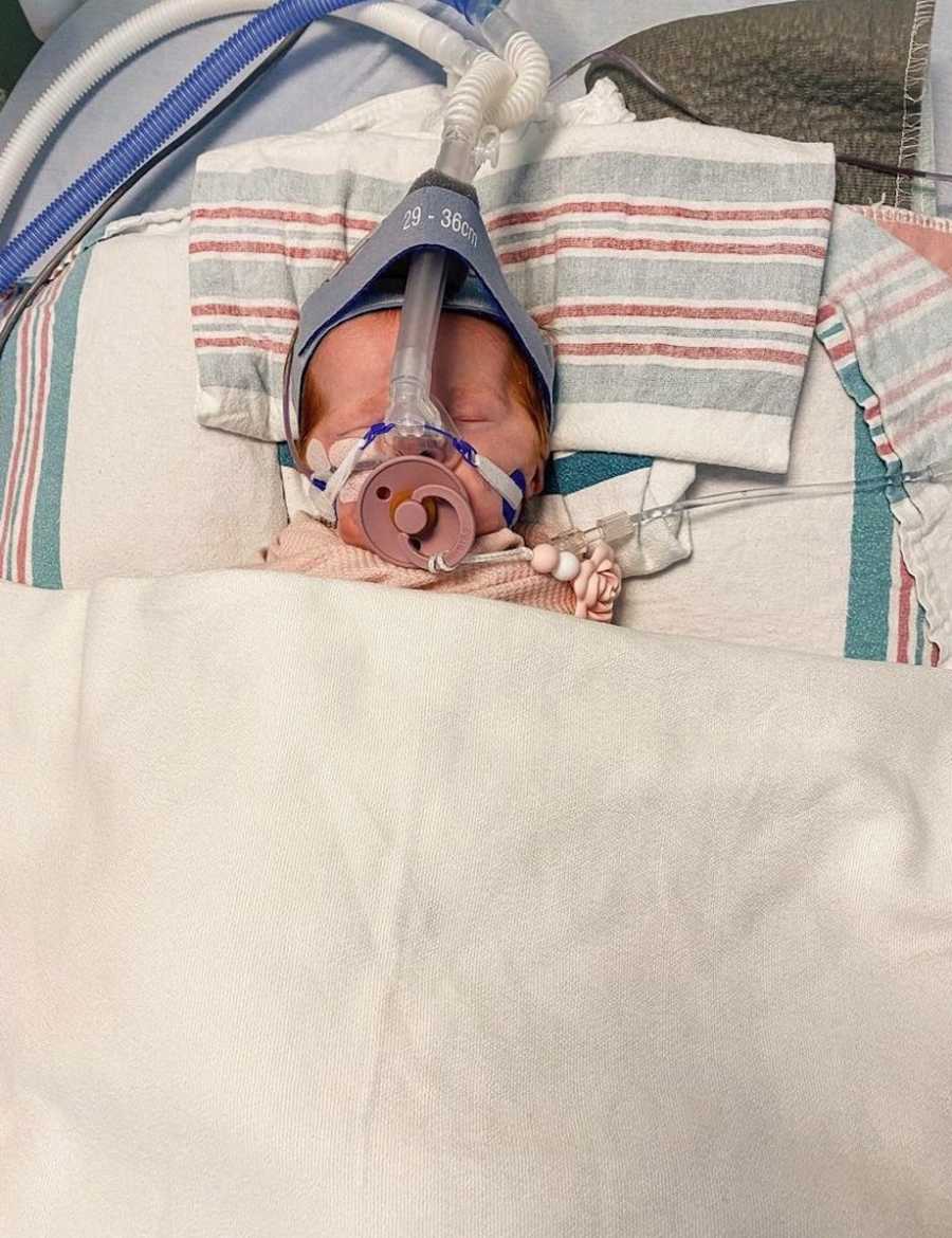 Newborn baby with birth defect