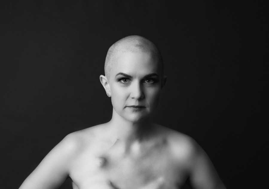 Woman battling breast cancer takes a beautiful black and white photo, showing off her strength