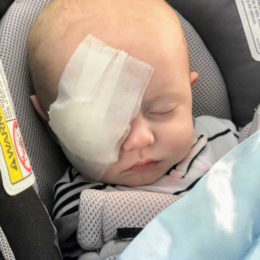 Baby boy after eye surgery in car seat