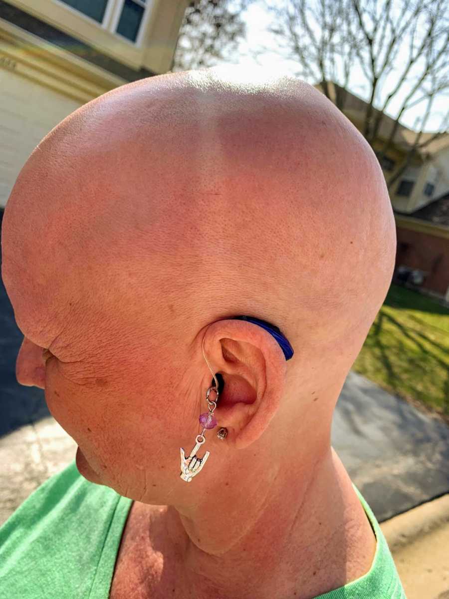Bald woman showing off hearing aid