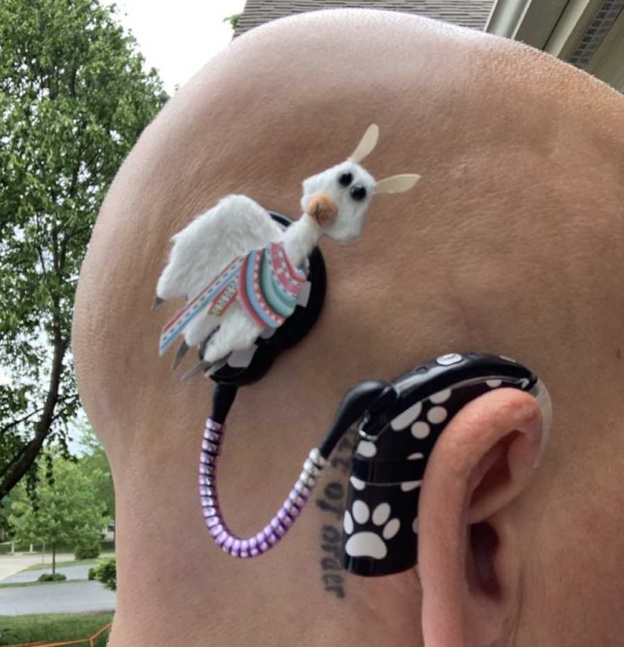 Woman showing off decorated cochlear implant