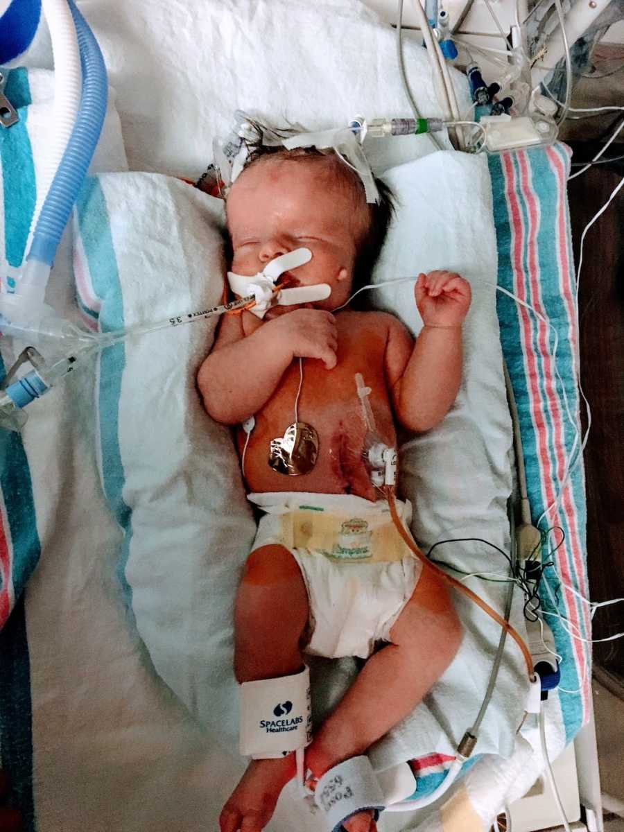 Newborn baby in wires and machines in hospital