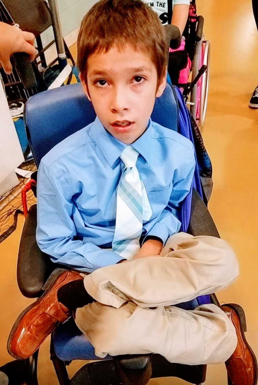 A boy with a rare chromosome disorder sitting in a wheelchair wearing a tie