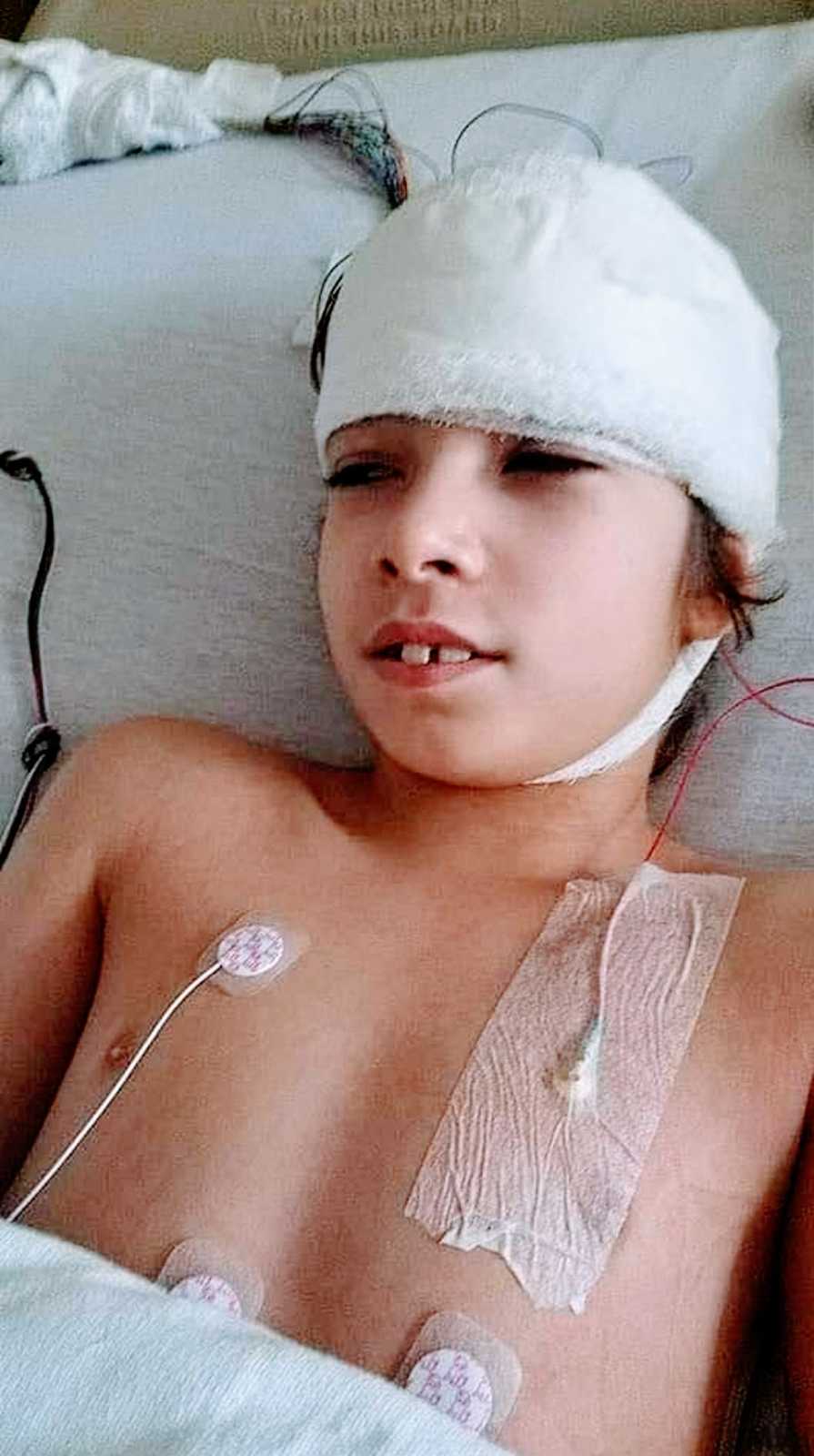 A boy with rare seizures lies in a hospital bed with bandages and wires